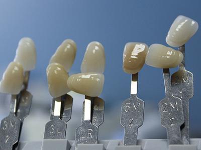 四环素牙修复案例